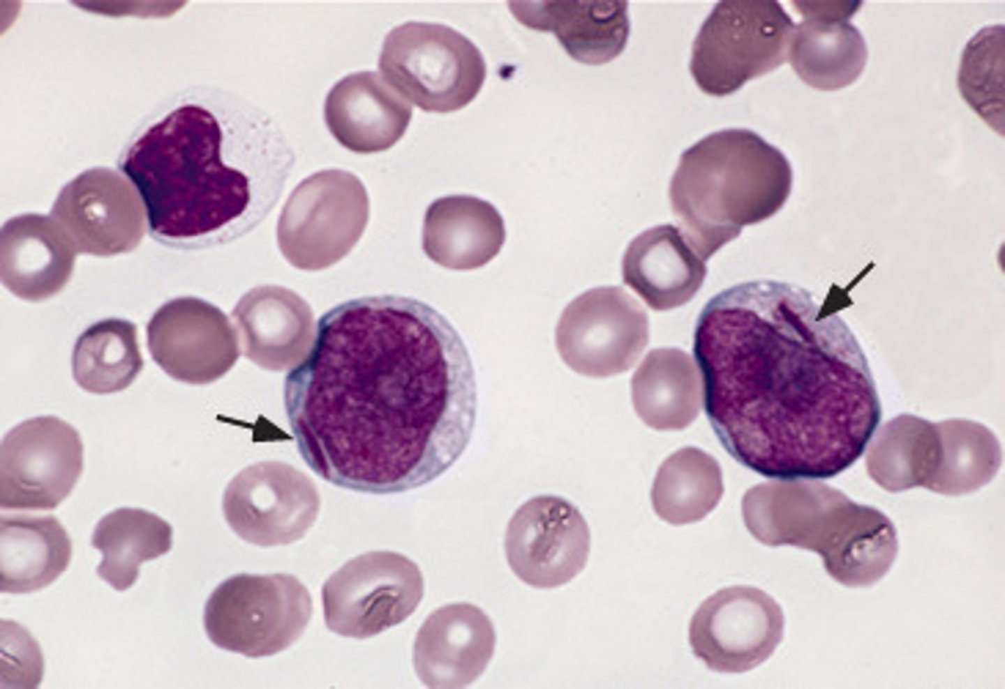 <p>structures in the cytoplasm of myeloblasts, myelocytes, and monoblasts</p>