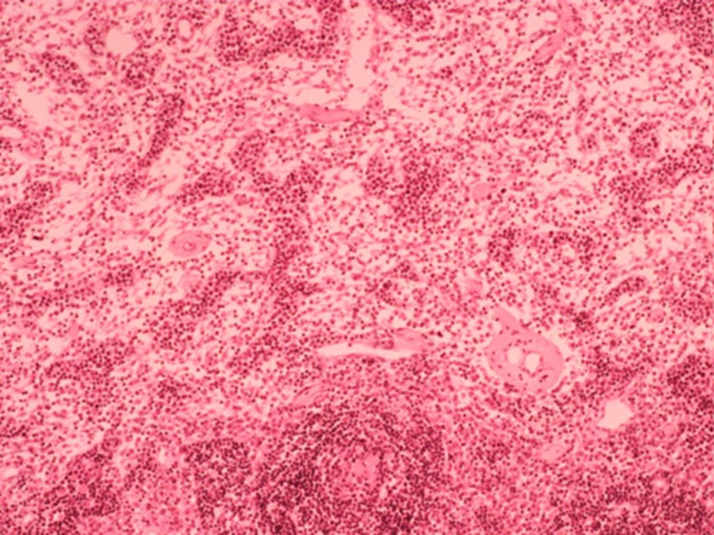 <p>ID structure</p><p>lymph node medulla</p>