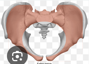 <p>what kind of pelvis is this? </p>