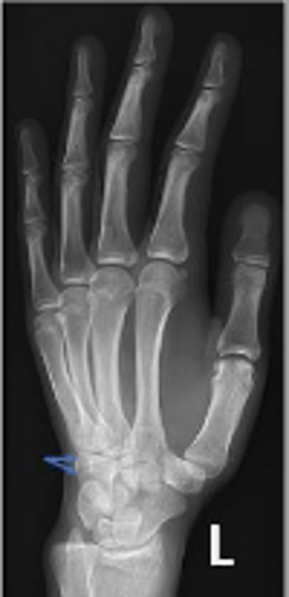 <p>What is the arrow pointing to?</p>