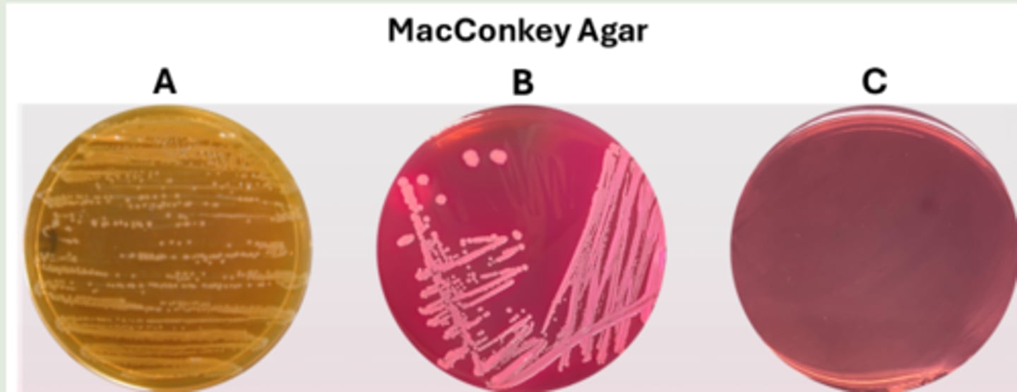 <p>the bacteria are Gram-negative and cannot ferment lactose</p>