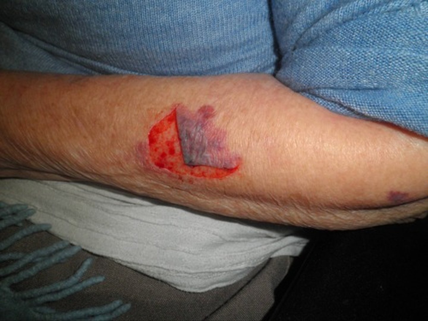 <p>Continuous for first 48 hours, then switch to dynamic</p>