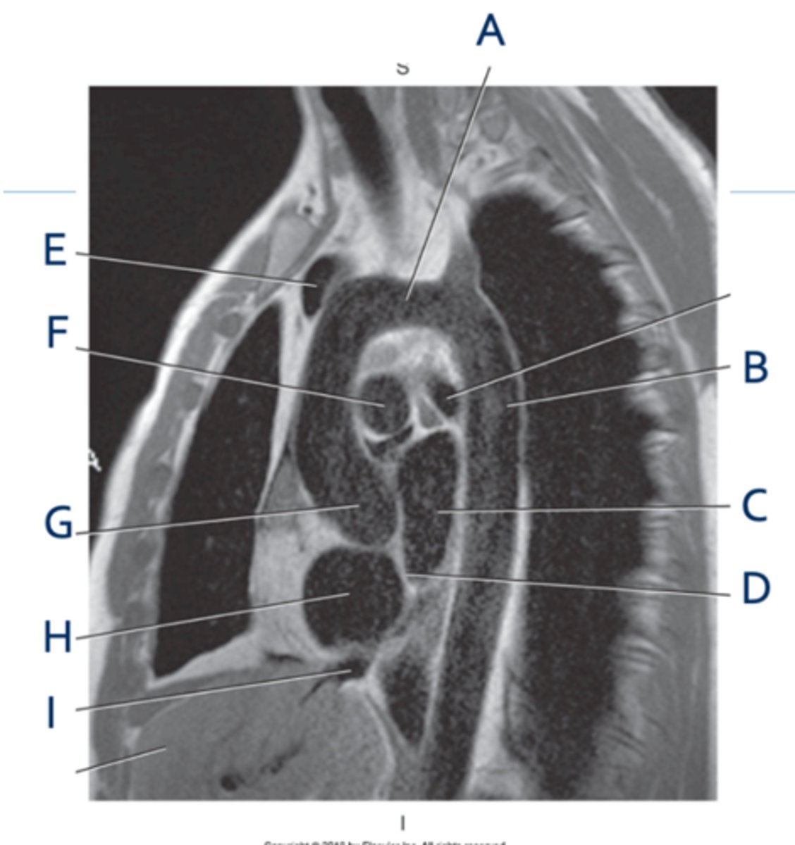 <p>Label F</p>
