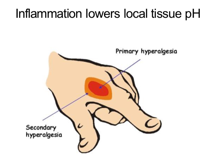 <p>Primary Hyperalgesia</p><ul><li><p>increased sensitivity at the injury site to prevent further tissue damage</p></li></ul><p>Secondary Hyperalgesia</p><ul><li><p>increased sensitivity around the injury site as inflammation lowers pH of local tissue (eg red area surrounding small cut)</p></li></ul><p></p>