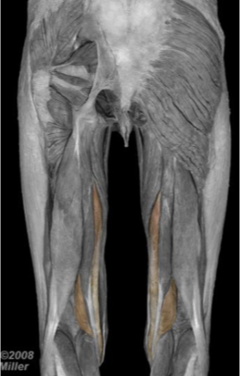 <p>Semimembranosus </p>