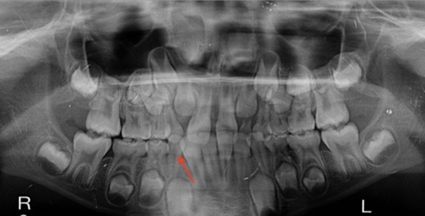 knowt flashcard image