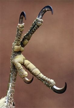 <p>What is this foot type? </p>