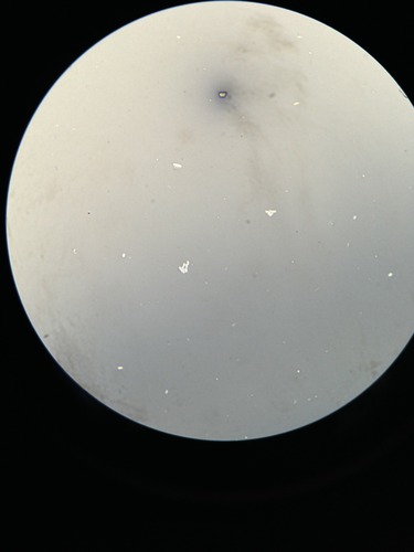 Identify the white structures