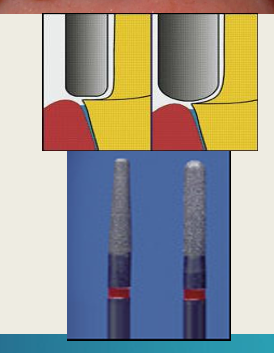 <p>ID which bur it is?</p>