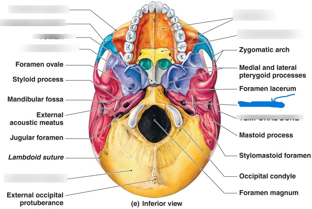 <p>What is this hole in the skull?</p>