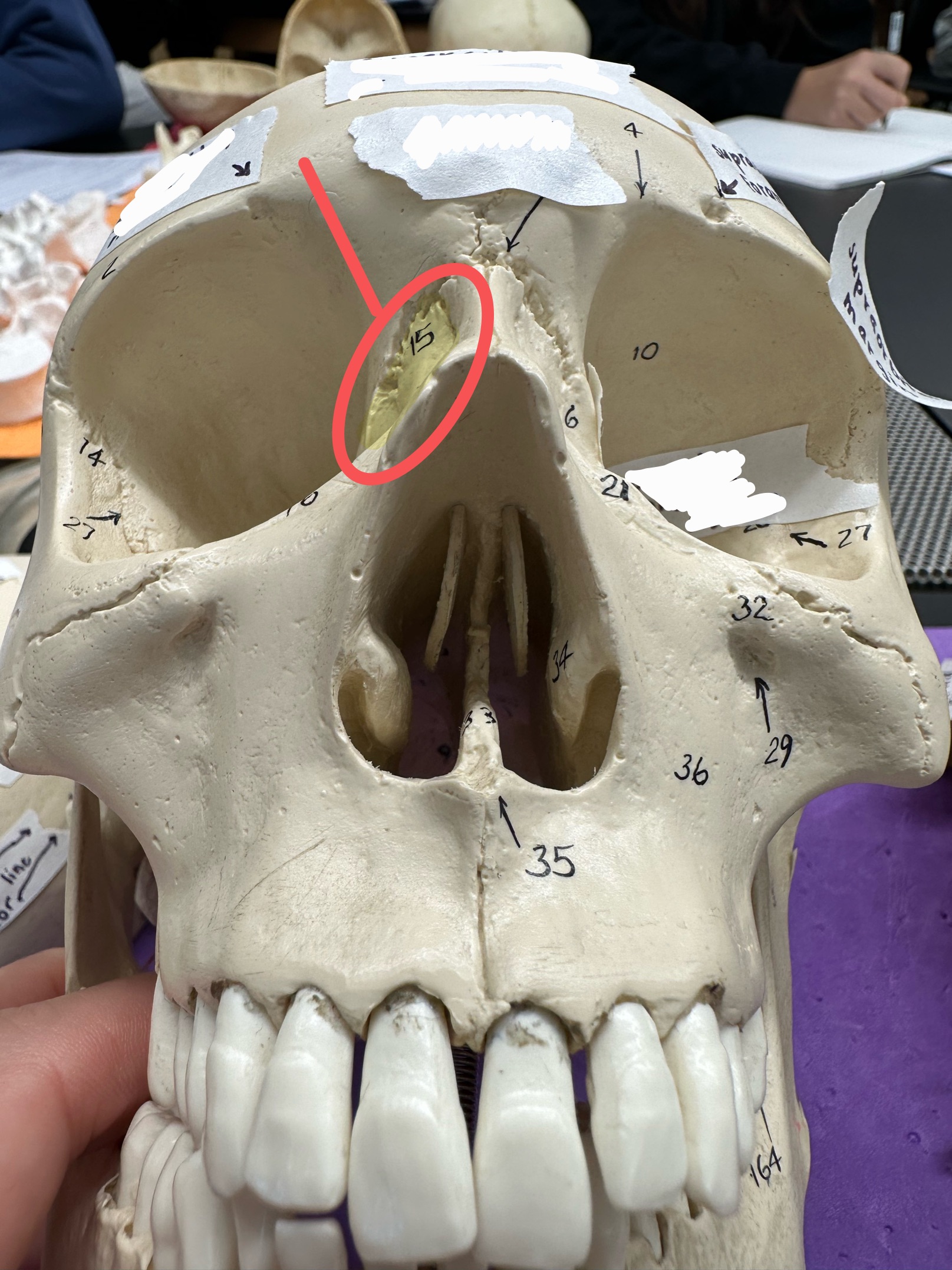 <p>ID bone</p>