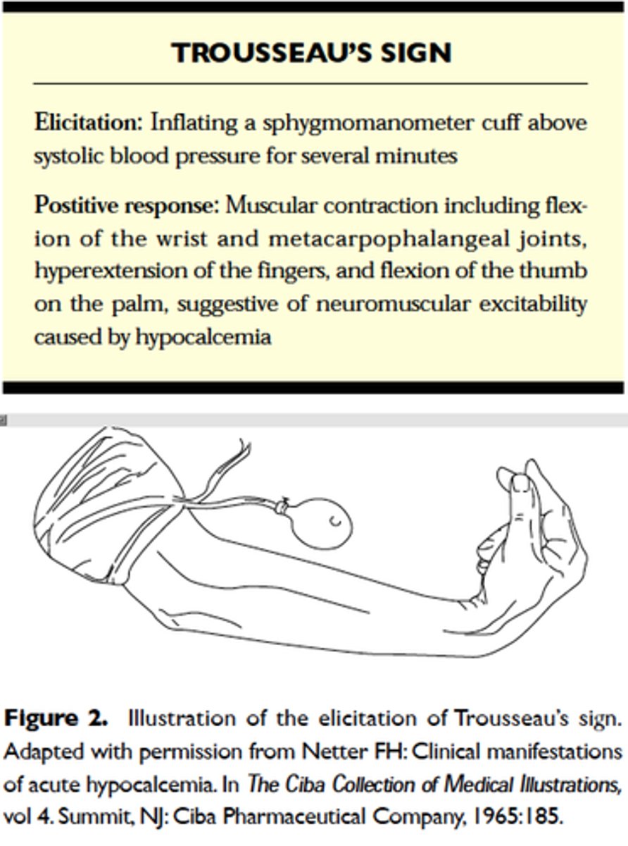 <p>A sign of hypocalcemia and early stages of tetany. Carpal spasm caused by inflating a blood pressure cuff above the client's systolic pressure and leaving it in place for 3 minutes.</p>