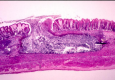 <p>The trophozoites of E. histolytica secrete enzymes that cause ___ producing the typical “<strong>flask-shaped” </strong>ulcer associated with the parasites</p><p>Note: Invasion of the portal circulation may occure leading to the development of abscess in the liver,lungs, and the brain</p>