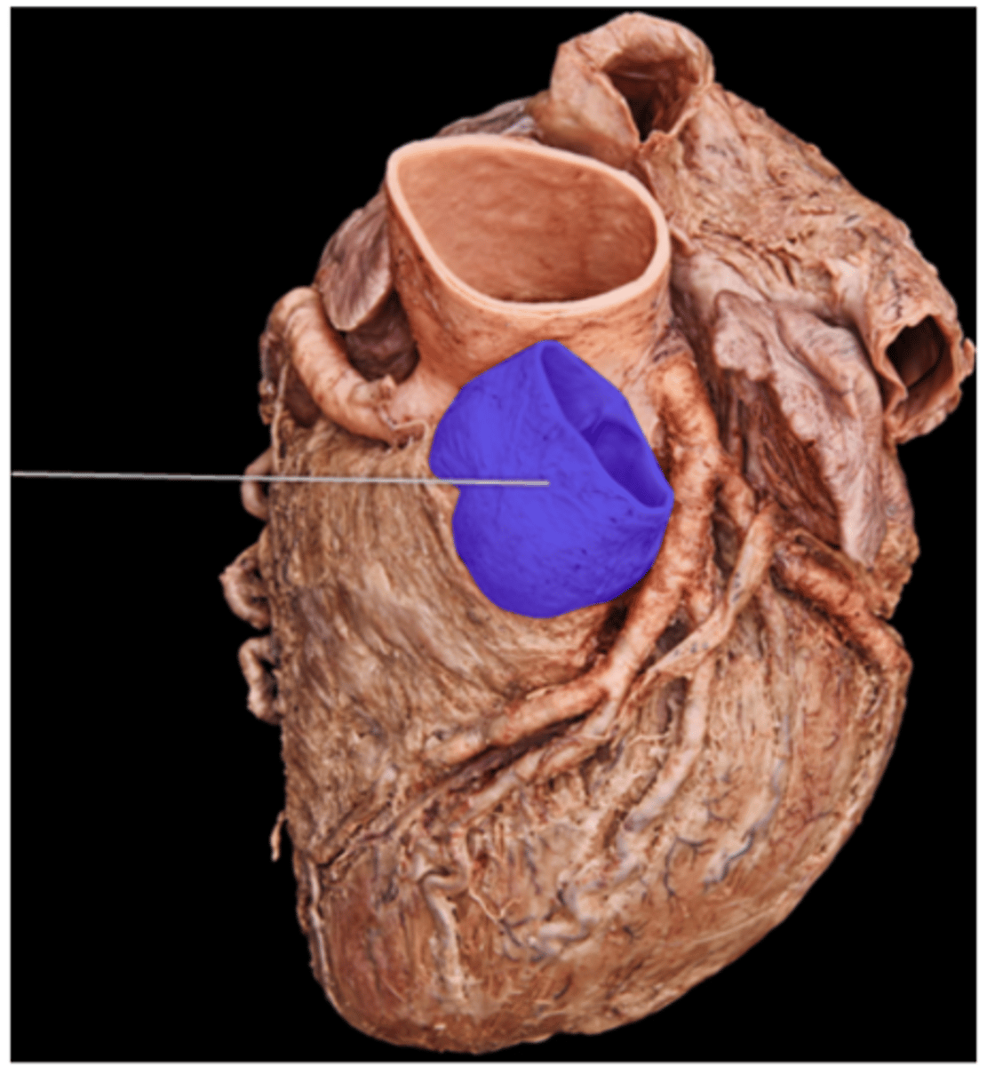 <p>pulmonary trunk</p>
