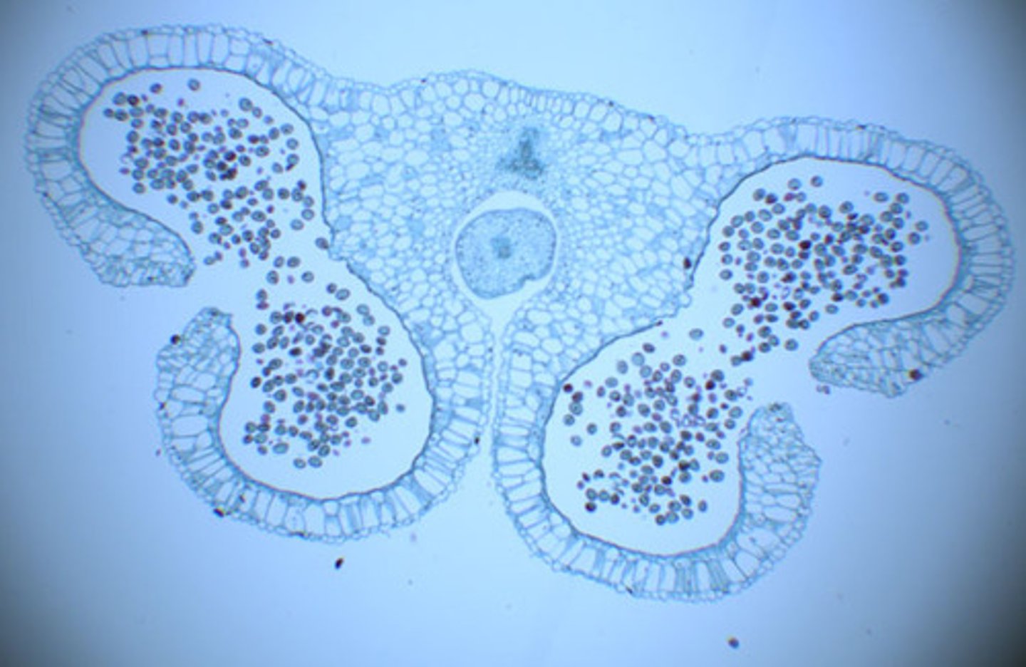 <p>male sporangia</p>