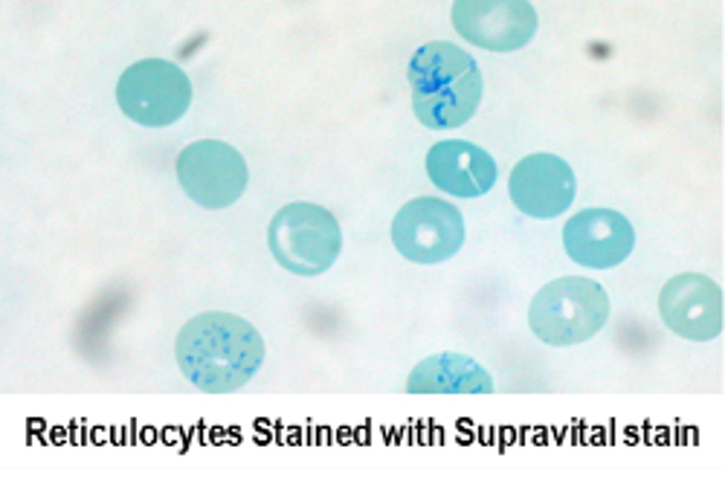 <p>Supervital stain, measures high and low angle scatters and absorbance</p>