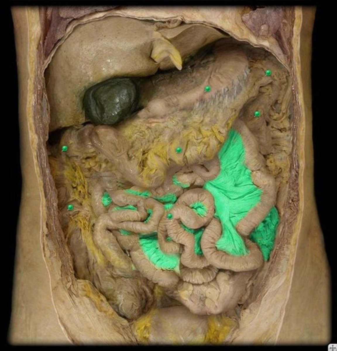 <p>attaches the small intestine to the posterior wall of the abdomen</p>