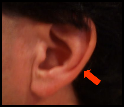 <p><span>outer portion of the ear is composed of cartilage with a thin covering of connective tissue and skin</span></p>