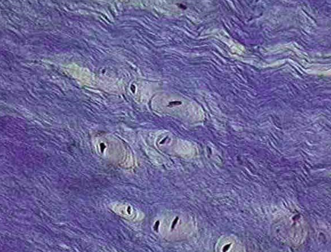 <ul><li><p>wavy matrix</p></li><li><p>contains collagen fibers</p></li><li><p>extremely tough</p></li><li><p>forms protective pads between</p><p>many bone surfaces, including in the <strong>knee joints.</strong></p><p>Such pads are most obvious between the</p><p><strong>vertebrae of the spine.</strong></p></li></ul><p></p>