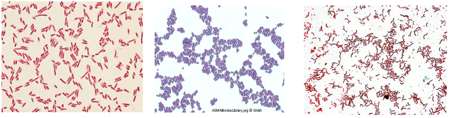 <p>going left to right: gram negative bacilli, gram positive cocci, gram negative spirilla </p>