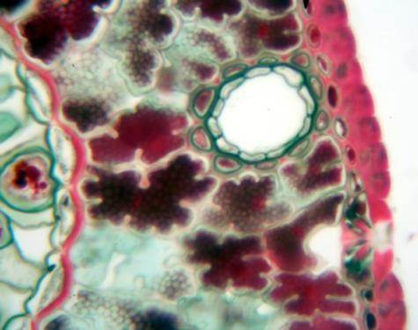 <p>A tubelike intercellular space that contains a clear, viscous liquid (resin) that protects the plant against herbivores and pathogens</p>