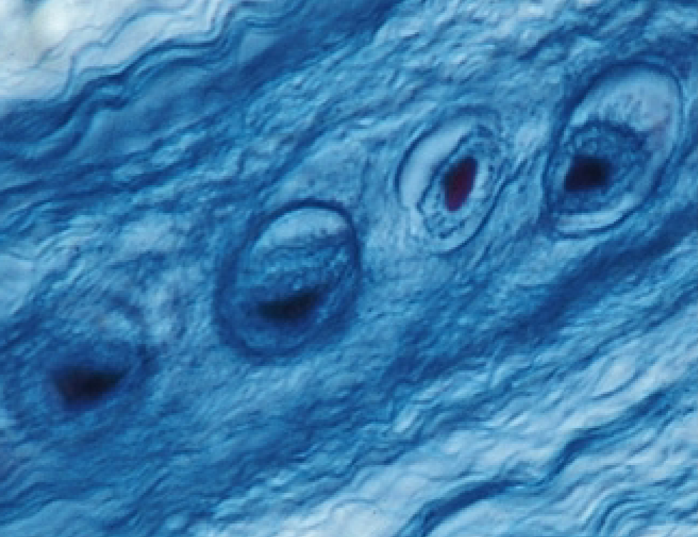 <p>What is the function of the Fibrocartilage? (connective tissue)</p>