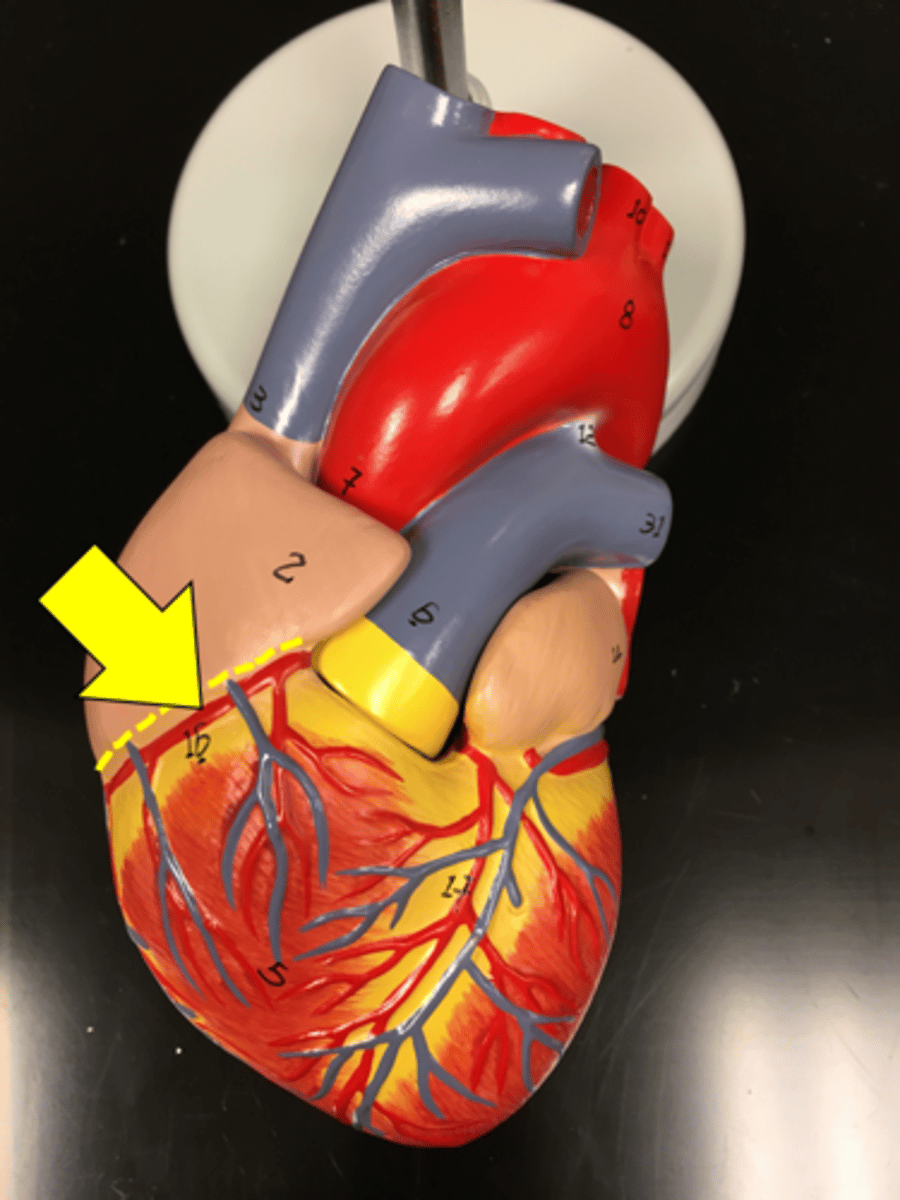 <p>Name the red vessel.</p>