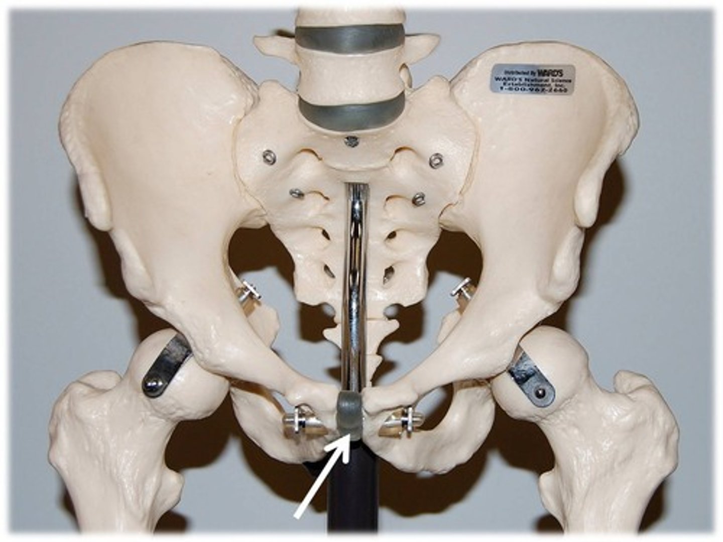 <p>Name this specific part of the coxal bone.</p>