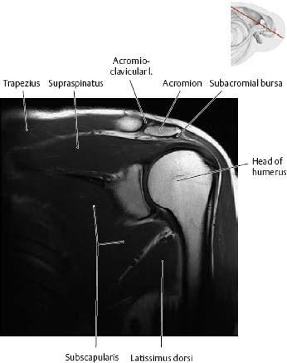 <p>To maintain the stability of the shoulder joint</p>