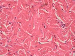 <p>Connective tissue with thick, interwoven collagen bundles; found in dermis and organ capsules.</p>