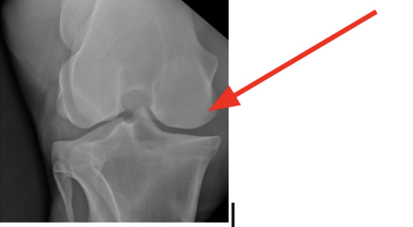 <p>3 y/o horse lameness, effusion of stifle, where is the cyst?</p>