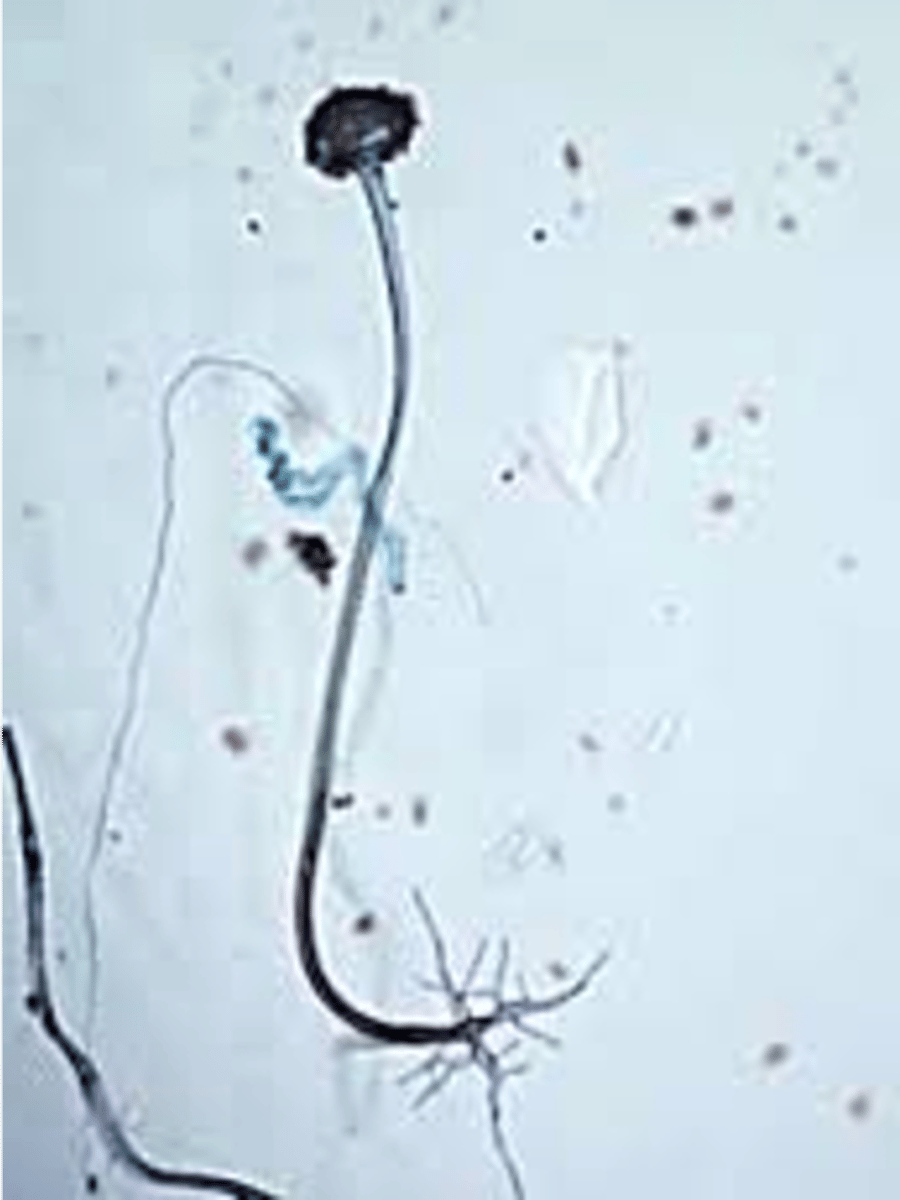 <p>spores inside vesicle and have root like apendages at base (rhizoids)</p>