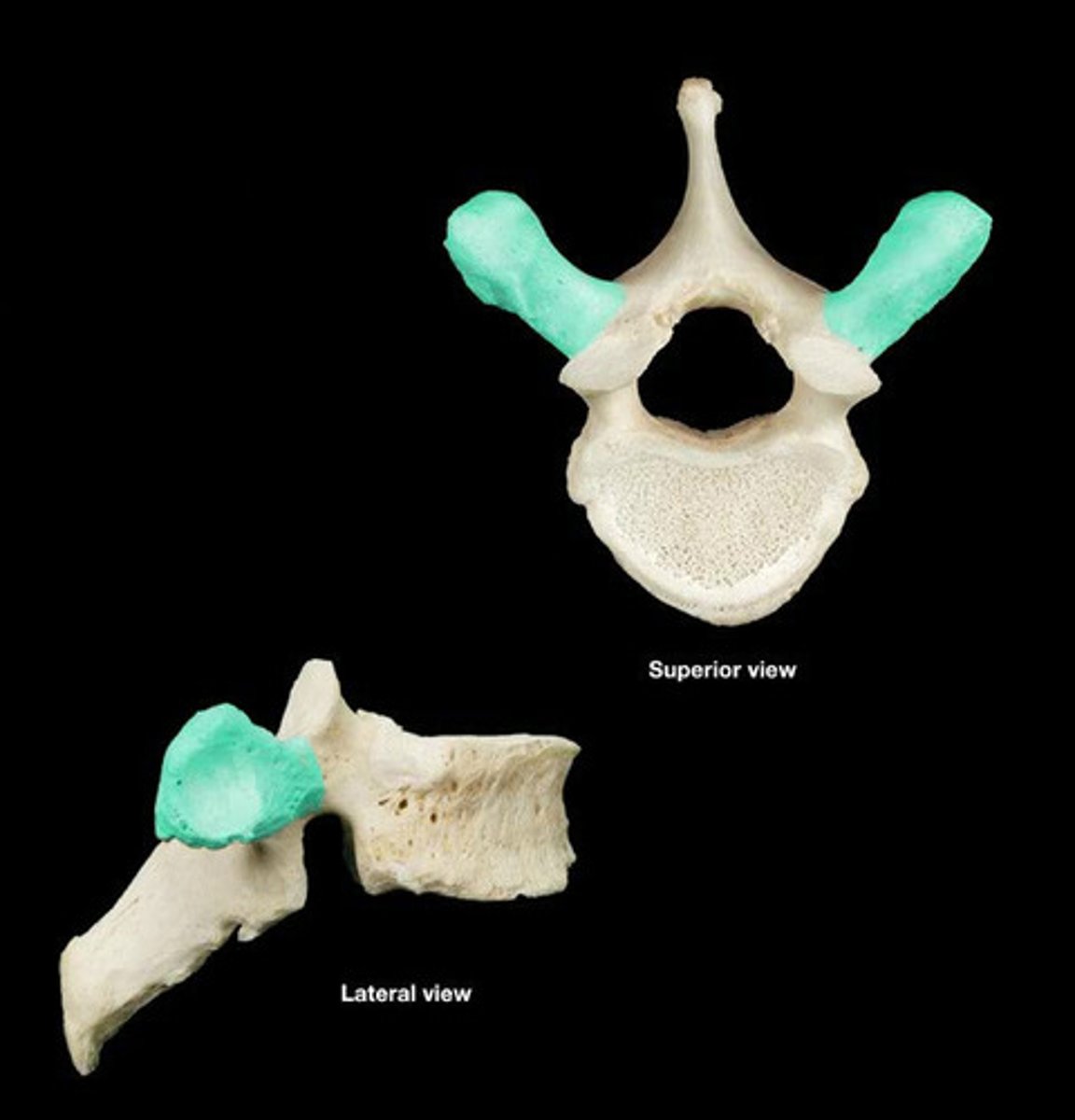 <p>articulate with ribs; attach to tuberculum of rib in vertebrates with biccipital ribs</p>