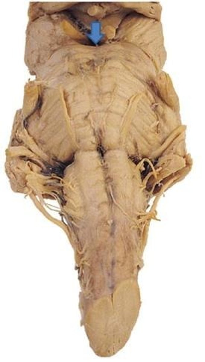 <p>interpeduncular fossa</p>