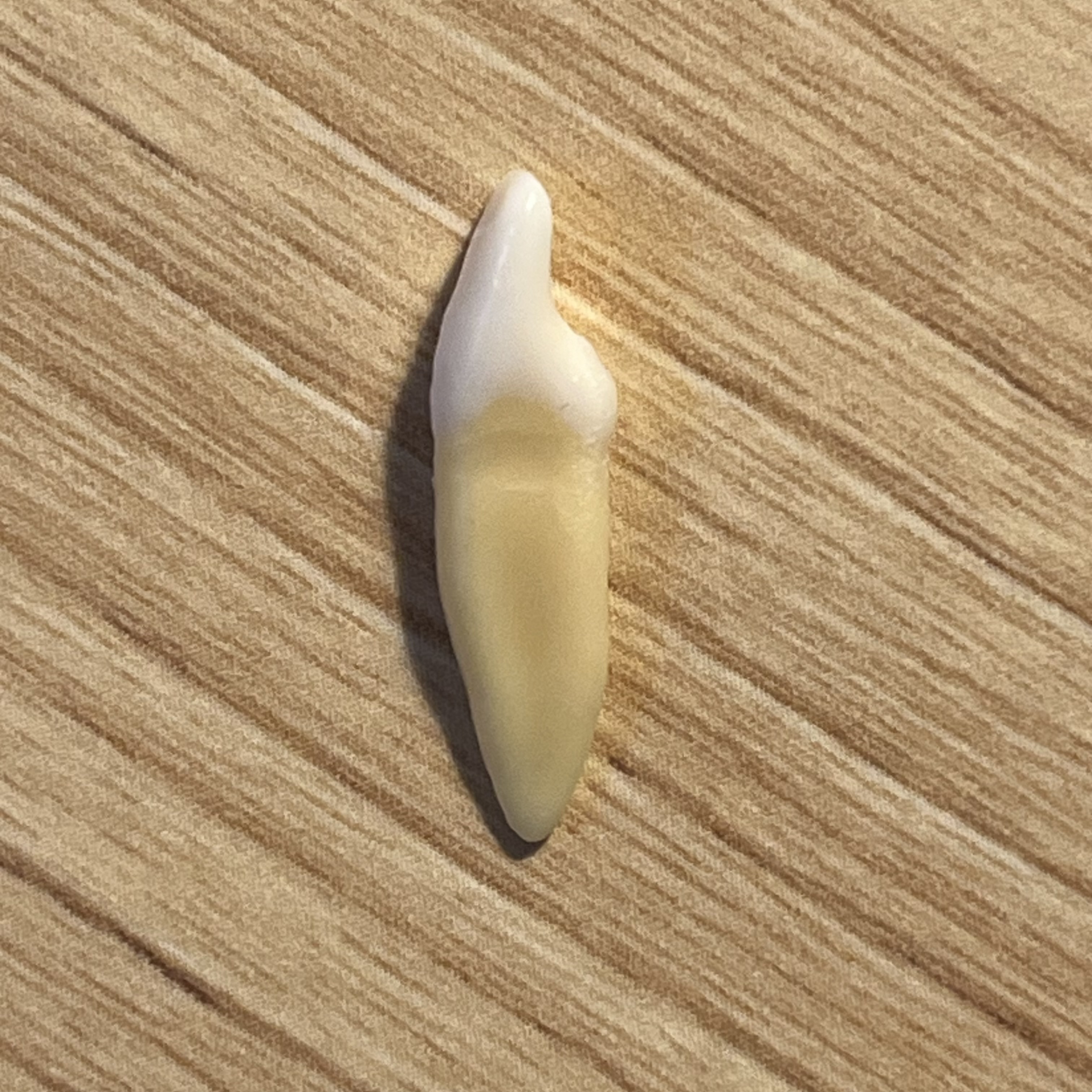 <p>What tooth is this (with view)?</p>