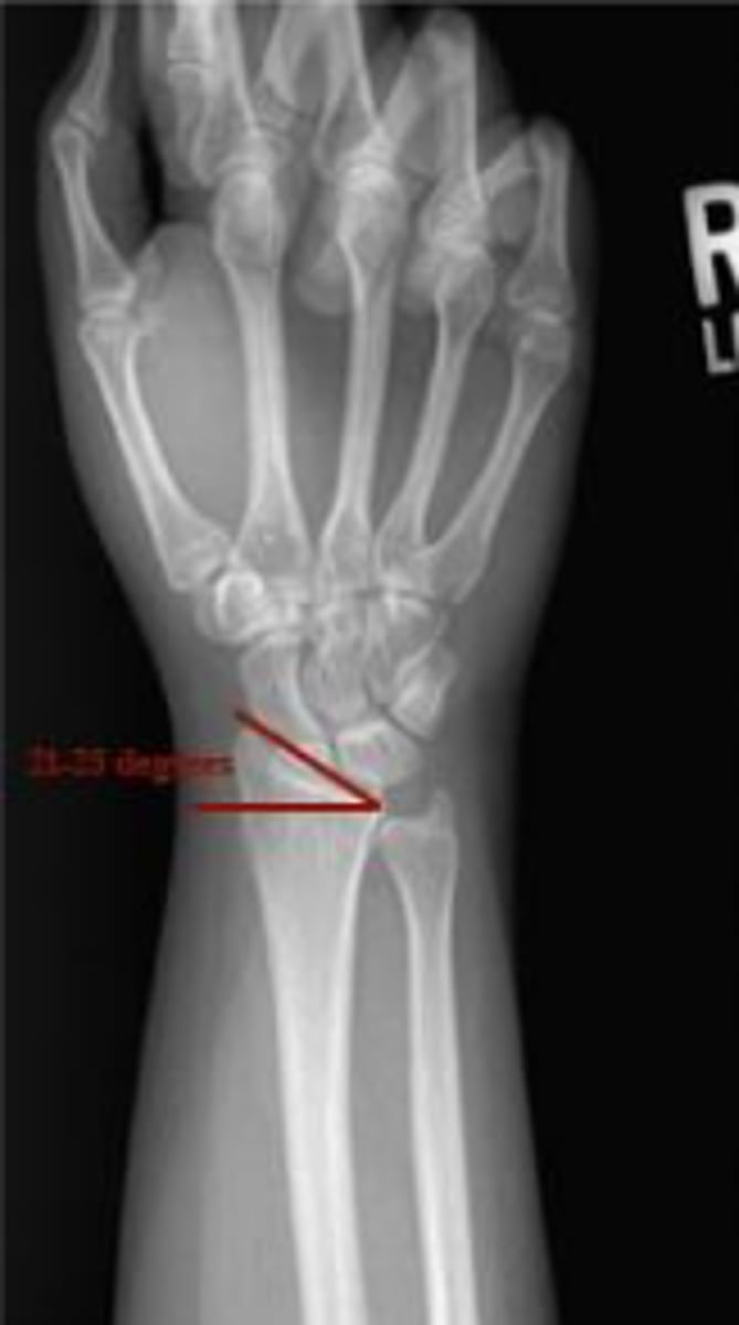 <p>Is the given range within normal limits?</p>