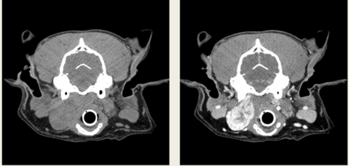 <p>which CT images are pre and post contrast? what type of window is being shown in both?</p>
