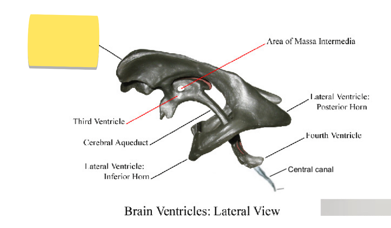 <p>Name this brain ventricle </p>