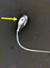 <p>Identify the sperm morphology.</p>