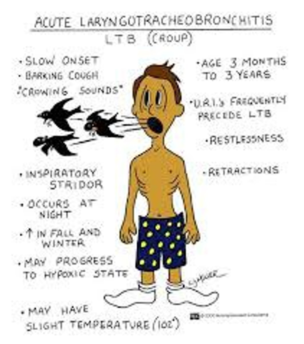 <p>Caused by parainfluenza virus</p><p>- barking cough, stridor, hoarseness</p><p>- inflamed larynx, trachea, bronchi = swelling and airway obstruction</p><p>- infects 6mo-3yrs</p><p>Spread via droplets</p>