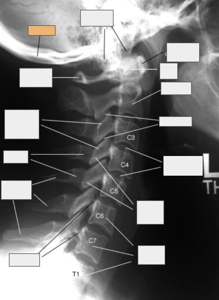 <p>What structure of the spine does the box highlighted in orange reference to?</p>