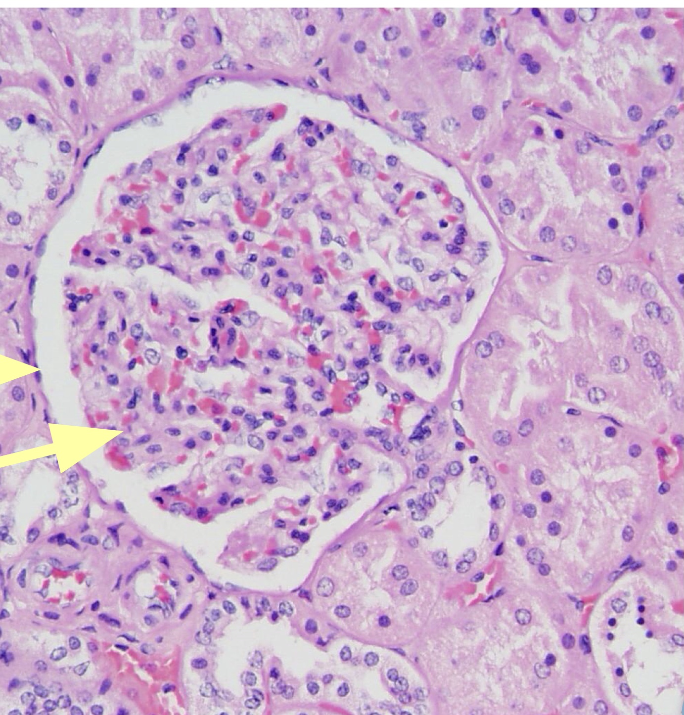 <p>Simple Squamous Epithelium </p>