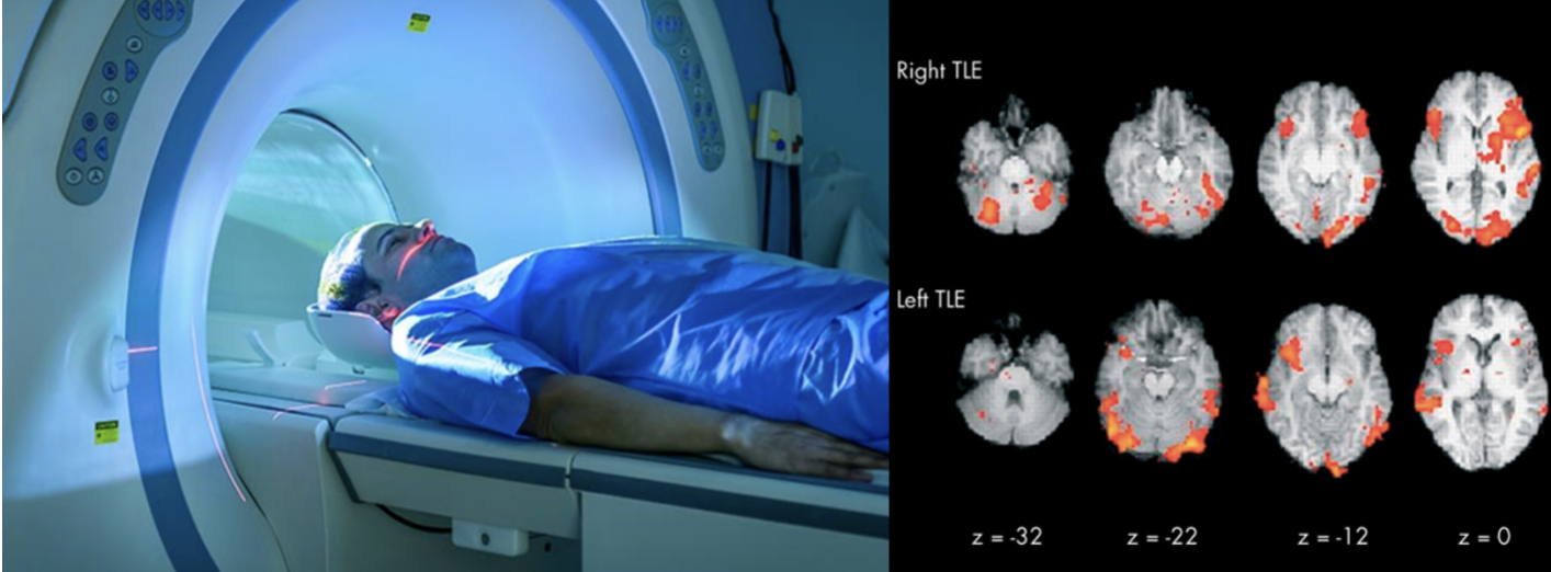 <p>What method of studying the brain is this?&nbsp;</p>