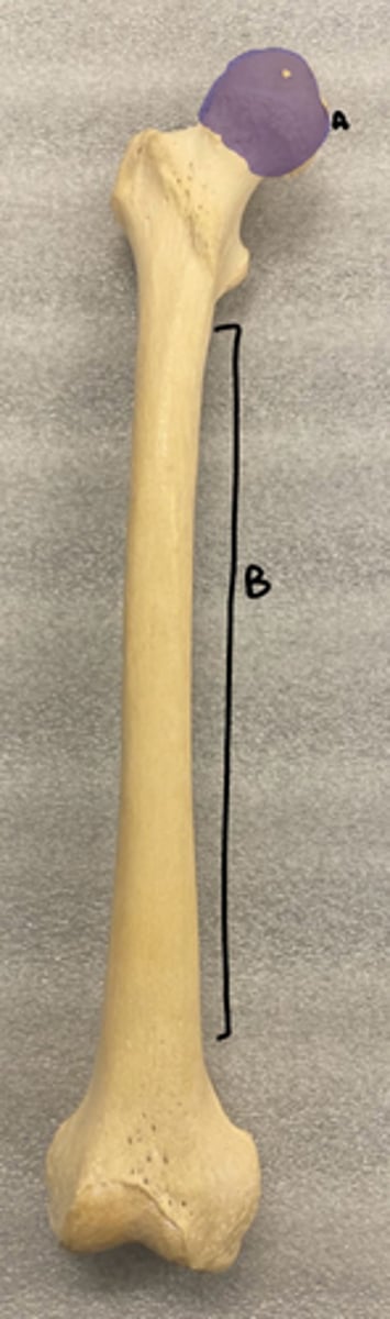 <p>B</p>