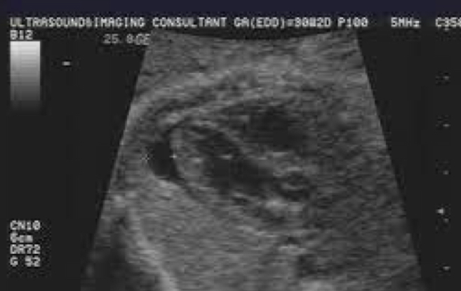 term image