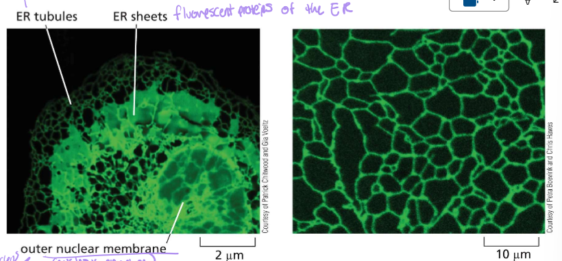 <p>Left: Rough ER next to the nuclear envelope</p><p>Right: Smooth ER exit sites</p>