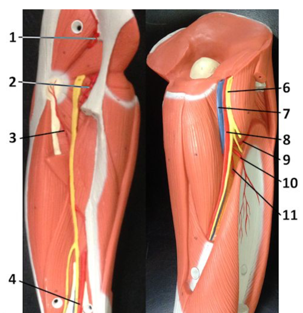 <p>Which artery is labeled #8?</p>