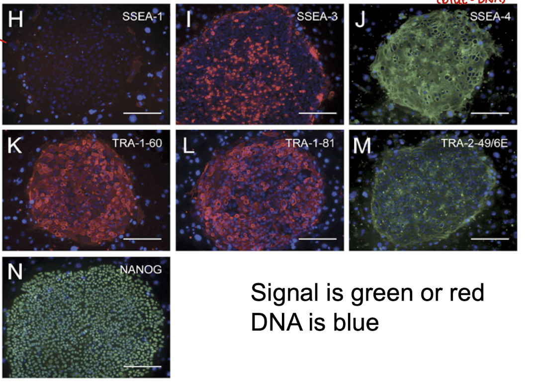 <p>which of these pictures shows ES cell surface markers?</p>