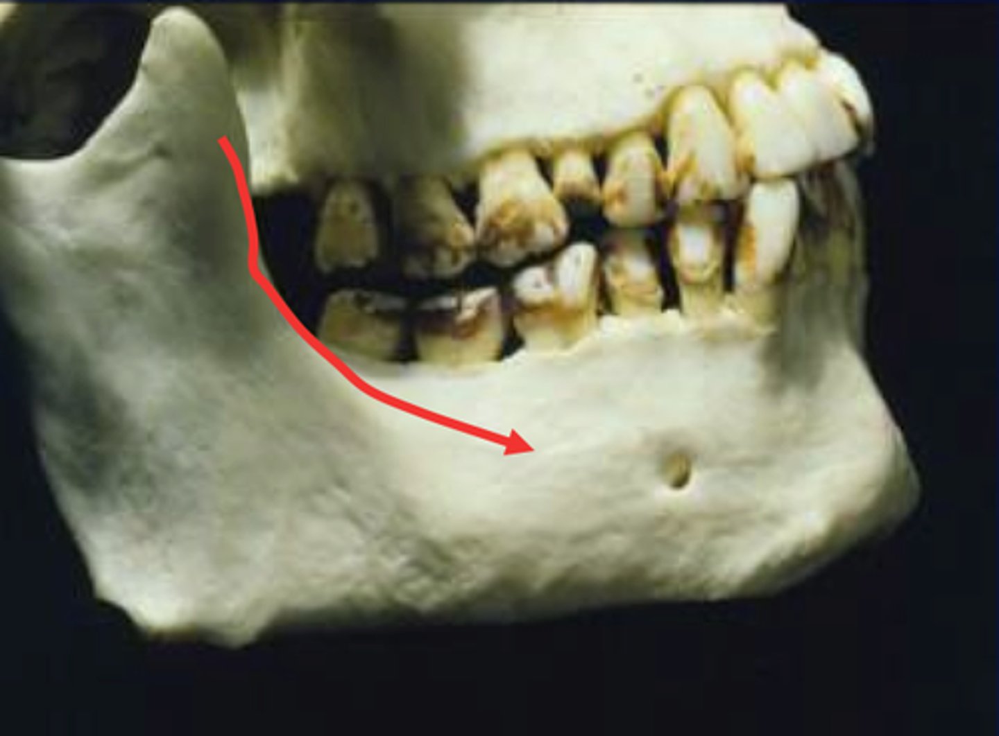 <p>External Oblique ridge.</p>