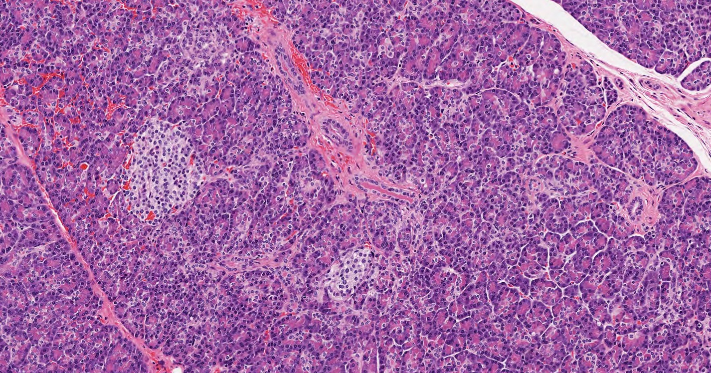 <p>Pancreatic islet</p>